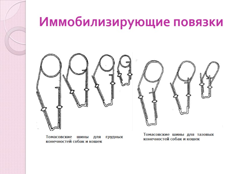 Иммобилизирующие повязки